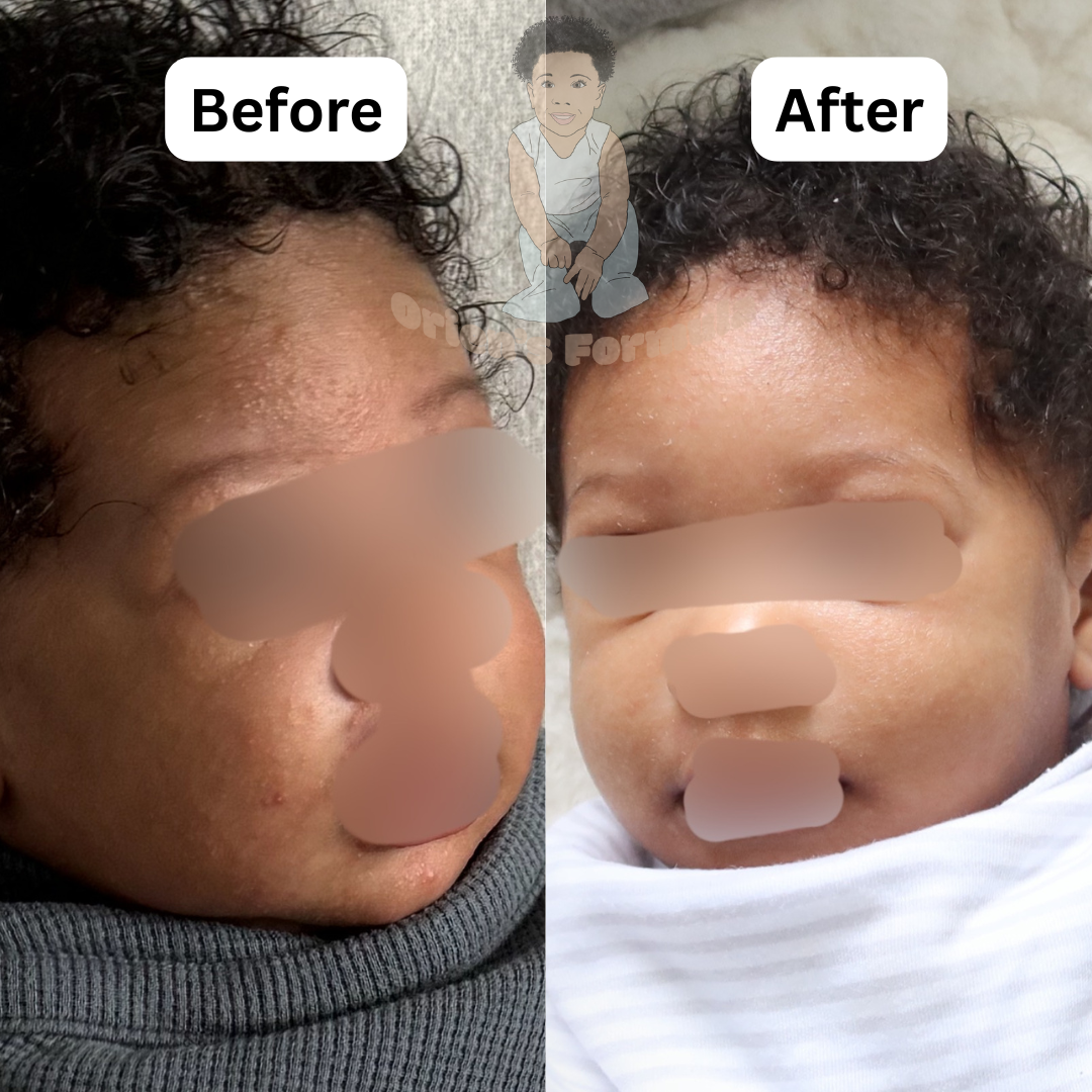 Orien's Mama Method: A Real Baby’s Skin Transformation
