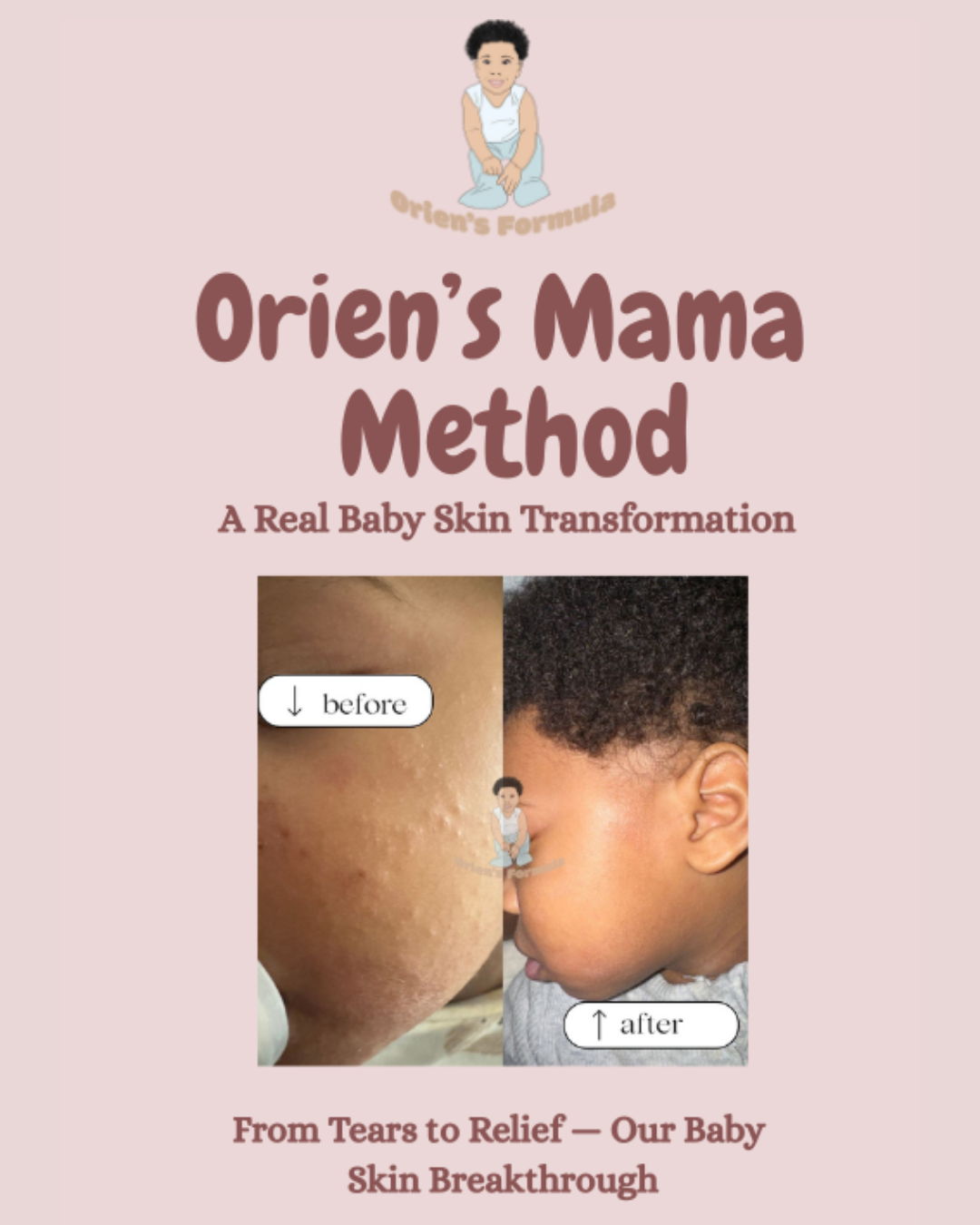 Orien's Mama Method: A Real Baby’s Skin Transformation